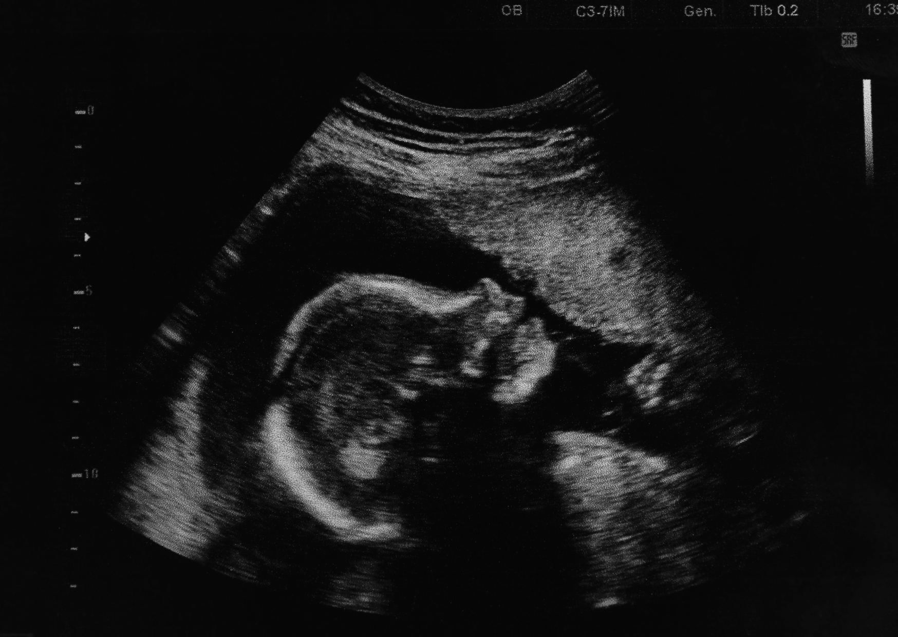 baby-lage baby-lage